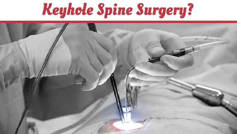 "Keyhole Spine Surgery Expertise of Dr. Vijay Mahantesh Pujari in Hubballi"