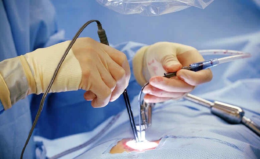 minimally-invasive-spine-surgery-in-hubli-why-percutaneous-lumbar-fixation-is-the-need-of-the-hour-thumbnail